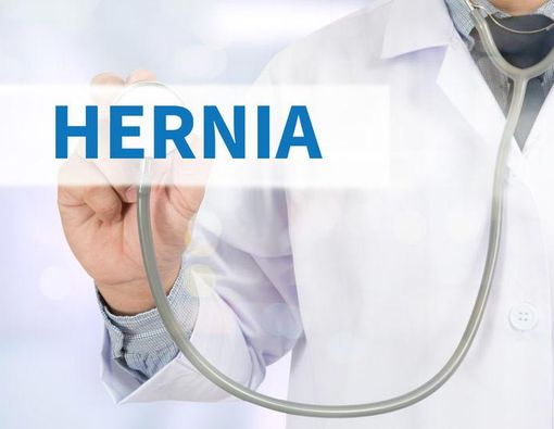 Ungkap Tuntas Soal Turun Berok