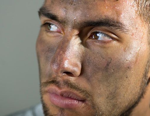 Inilah Akibatnya Jika Tidak Mandi!