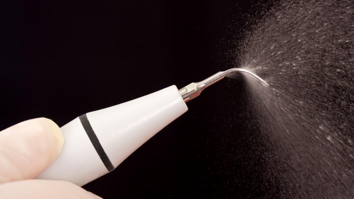 Gunakan Alat Pembersih Karang Gigi Sendiri, Amankah?