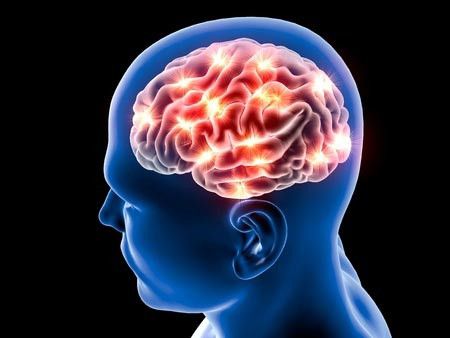 Sakit Kepala Pertanda Tumor Otak,  Mitos atau Fakta?