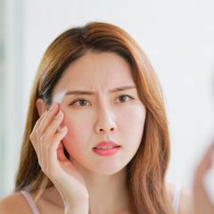 7 Cara Mudah Mengatasi Mata Merah yang Mengganggu