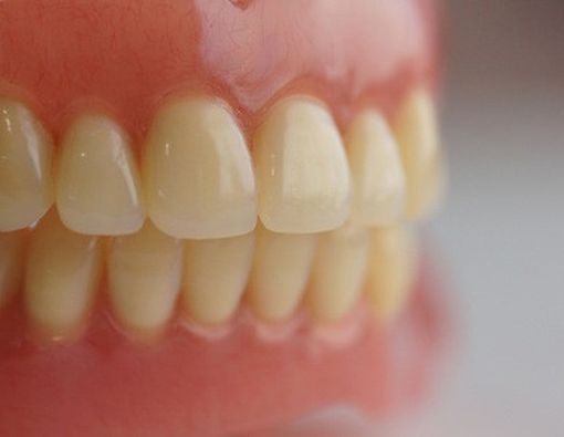 Hal-Hal yang Perlu Diketahui Soal Erosi Gigi