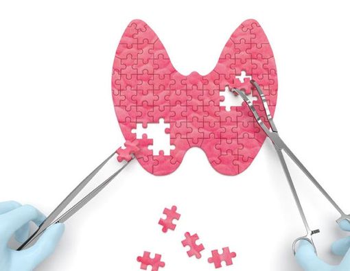 Dapatkah Kanker Tiroid Disembuhkan?