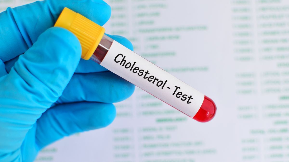 Pemeriksaan Kolesterol yang Perlu Kamu Tahu