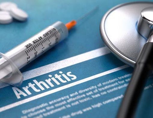 Suntikan Steroid untuk Obati Radang Sendi