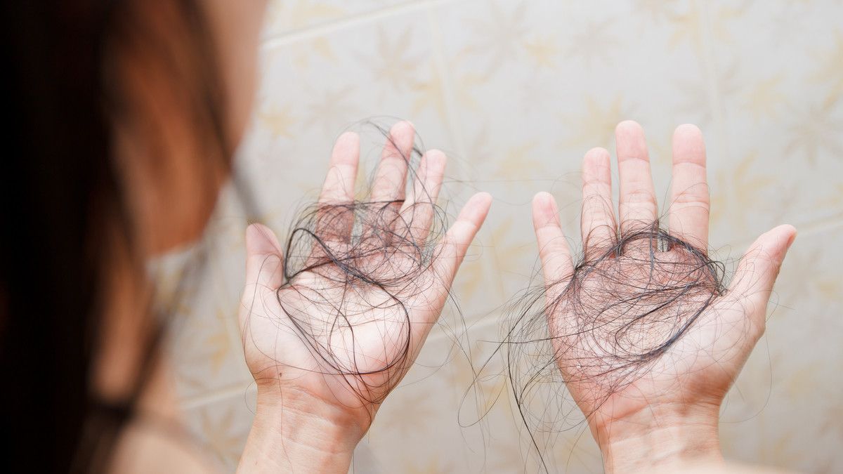 Rambut Menipis, Atasi dengan Cara Ini