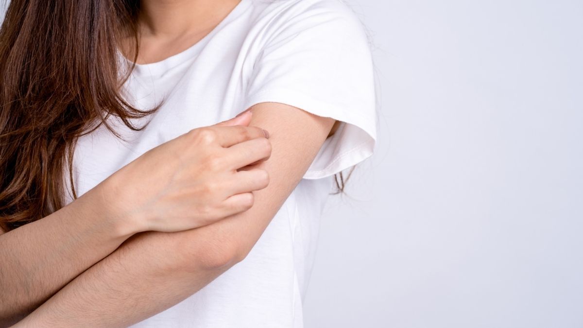 9 Penyebab Biduran Kronis yang Tak Kunjung Sembuh