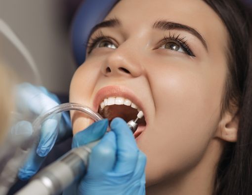 Hal yang Perlu Diketahui Soal Perawatan Polishing Gigi