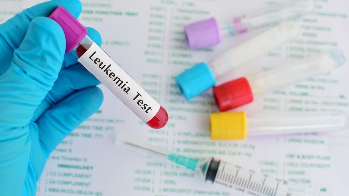 Deteksi Dini Leukemia, Bisakah Dilakukan?