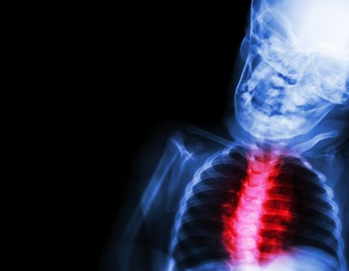 Faktor Penyebab Penyakit Jantung Bawaan pada Janin