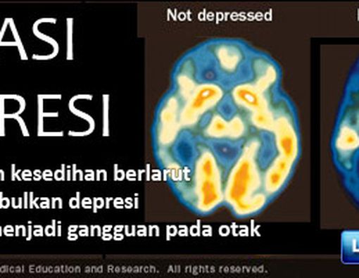 Atasi Depresi