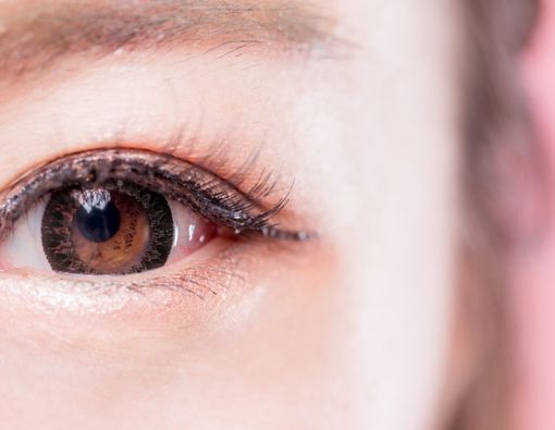 Operasi LASIK untuk Mata Silinder, Apakah Terbukti Bermanfaat?