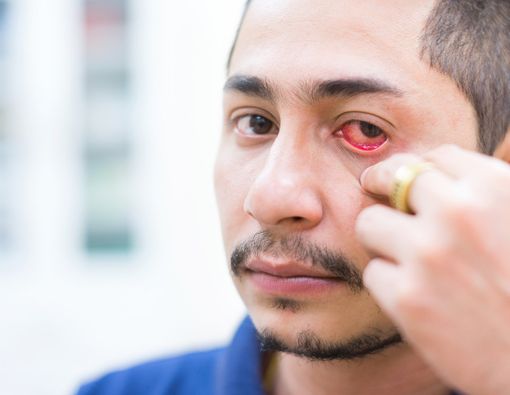 Benarkah Obat Disfungsi Ereksi Picu Gangguan pada Mata?