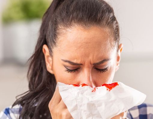 Bisakah Mimisan Terjadi Karena Kelelahan?