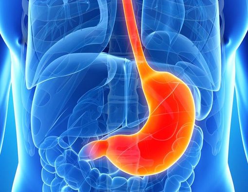 Operasi Ikat Lambung untuk Turunkan Berat Badan