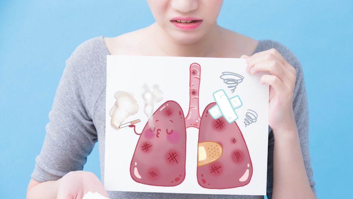 Kiat-Kiat Mempercepat Pemulihan Pasca-Lobektomi Kanker Paru