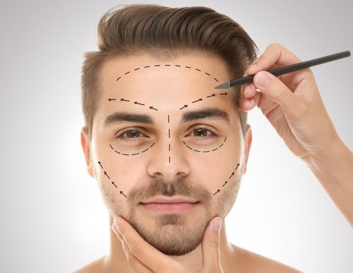 Bisakah Jidat Jenong Dikecilkan dengan Cara Operasi?