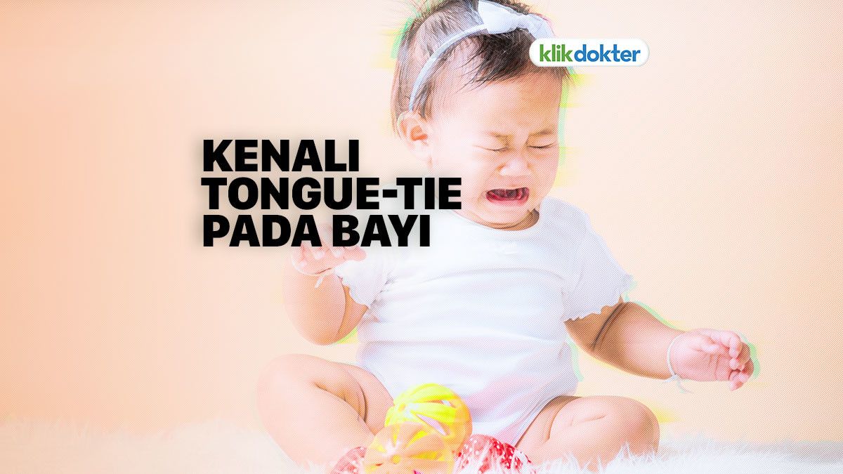 Ketika Bayi Menderita Tongue-tie