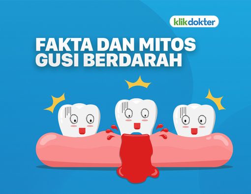Kenali Fakta dan Mitos Gusi Berdarah