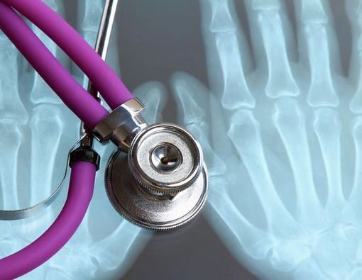 Beda Osteopenia dan Osteoporosis