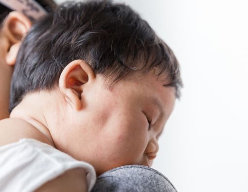 Tips Cegah Anak Kena Biang Keringat di Musim Panas