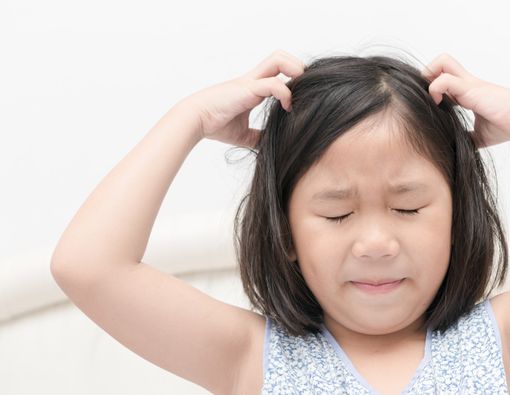 Muncul Ketombe pada Anak, Atasi dengan Cara ini