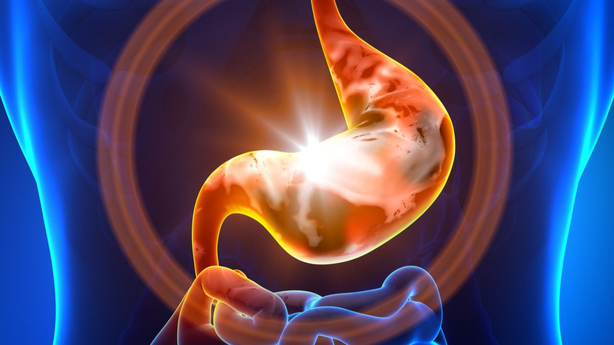 5 Pantangan Makanan untuk Penderita Sakit Lambung