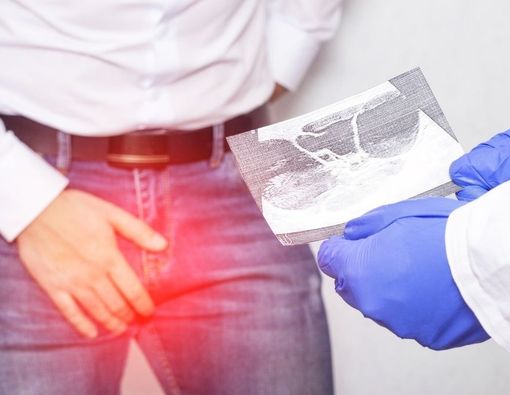 Penyebab Pria Hanya Punya Satu Testis atau Monorchism