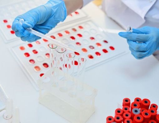 Pasangan Golongan Darah O dan AB Sulit Punya Anak? Ini Penjelasannya