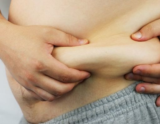 Dampak Buruk Obesitas pada Kulit yang Mesti Diwaspadai