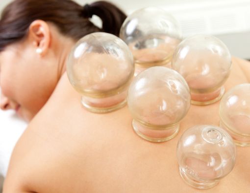 Risiko Terapi Bekam bagi Ibu Hamil