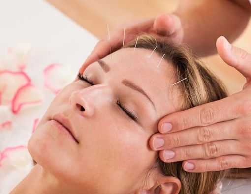 Cegah Penuaan Dini dengan Terapi Akupunktur