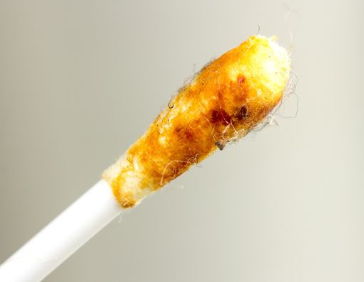 Benarkah Kotoran Telinga Berhubungan dengan Tingkat Stres Tubuh?