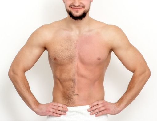 Perawatan Setelah Waxing untuk Cegah Iritasi Kulit