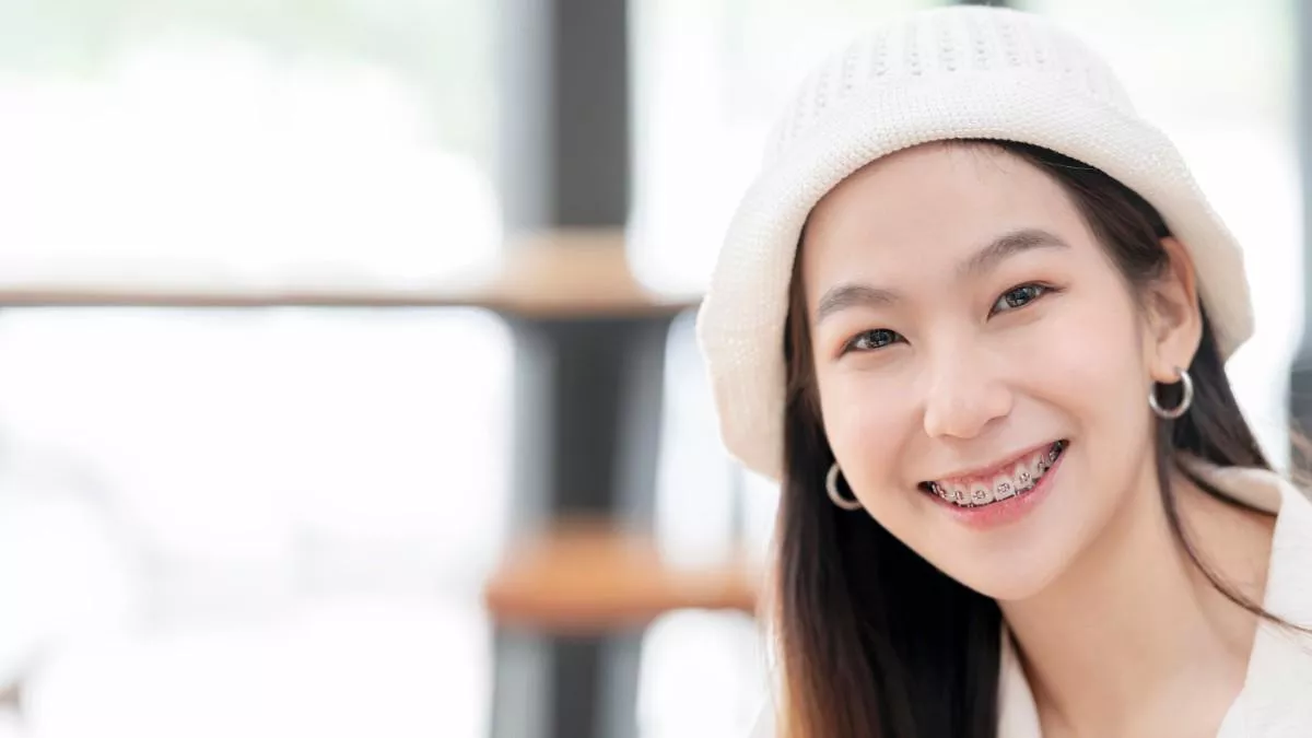 Batasan Usia Efektif Menggunakan Kawat Gigi