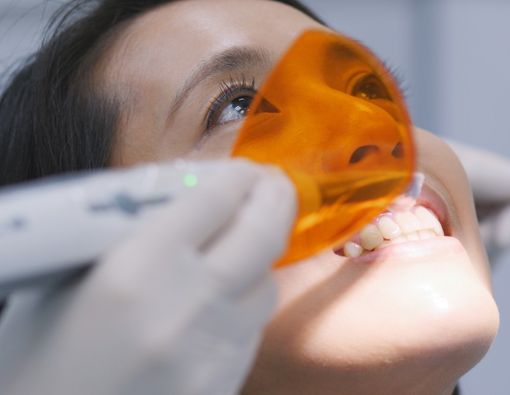 Apa yang Dimaksud dengan Restorasi Gigi?