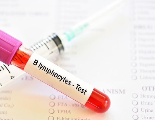 Penyebab Limfosit Tinggi dan Cara Mengatasinya