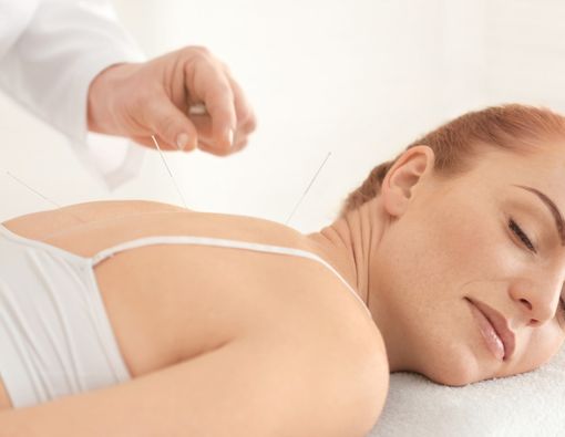 Bolehkah Wanita Menjalani Akupunktur Saat Hamil?