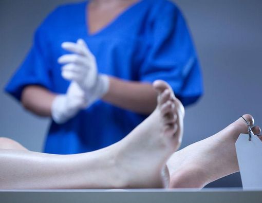 Mengapa Penyebab Kematian Perlu Diketahui?