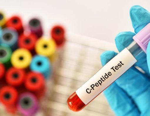 Mengenal Tes C-Peptide untuk Penderita Diabetes