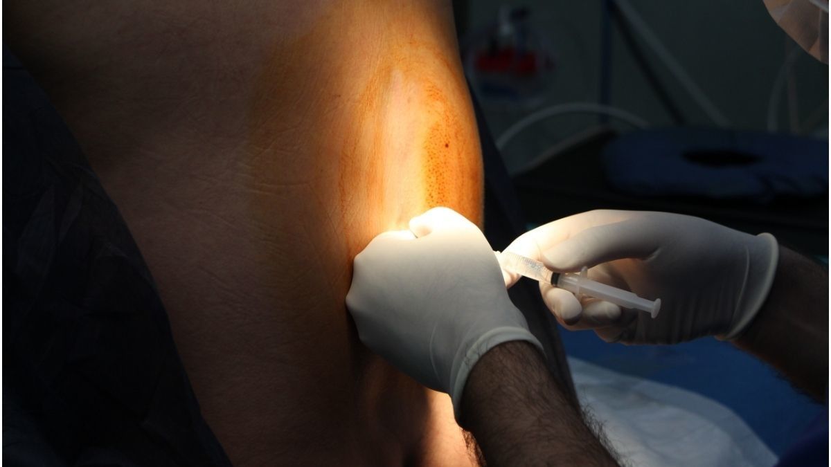 Deretan Mitos dan Fakta Bius Epidural saat Melahirkan