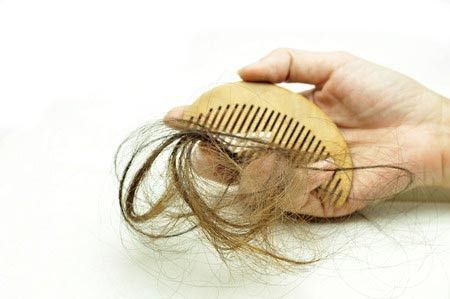 Inilah Penyebab Rambut Rontok Pada Wanita