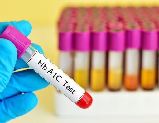 Bahaya Kadar HbA1C Tinggi bagi Kesehatan