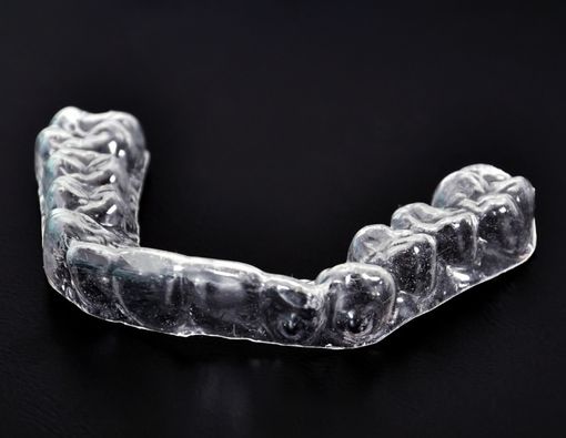 Mengenal Dental Splinting, Perawatan untuk Gigi yang Goyang