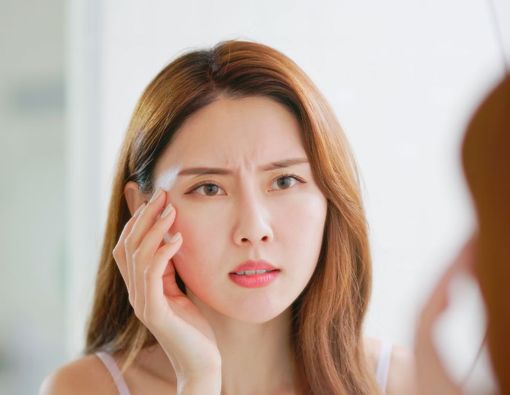 7 Cara Mudah Mengatasi Mata Merah yang Mengganggu