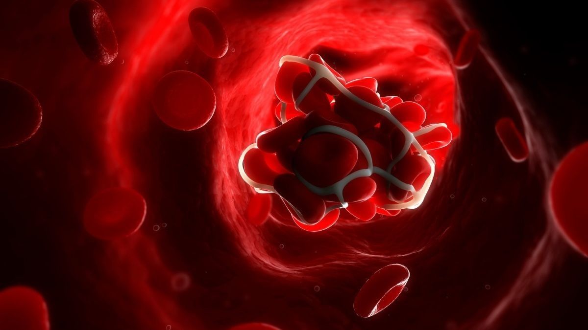 Mengenal Proses Pembekuan Darah Atau Koagulasi Klikdokter