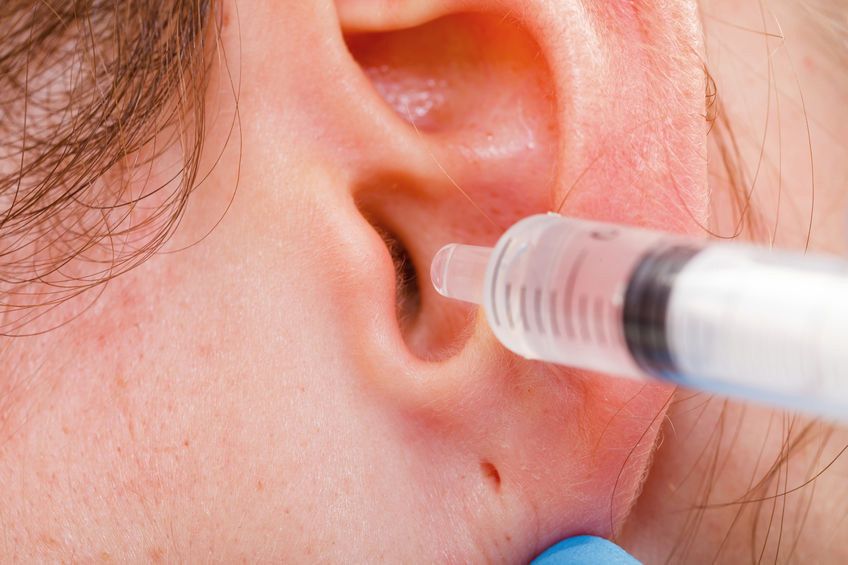 Mengatasi Serumen Prop, Penyebab Rasa Mengganjal di Telinga