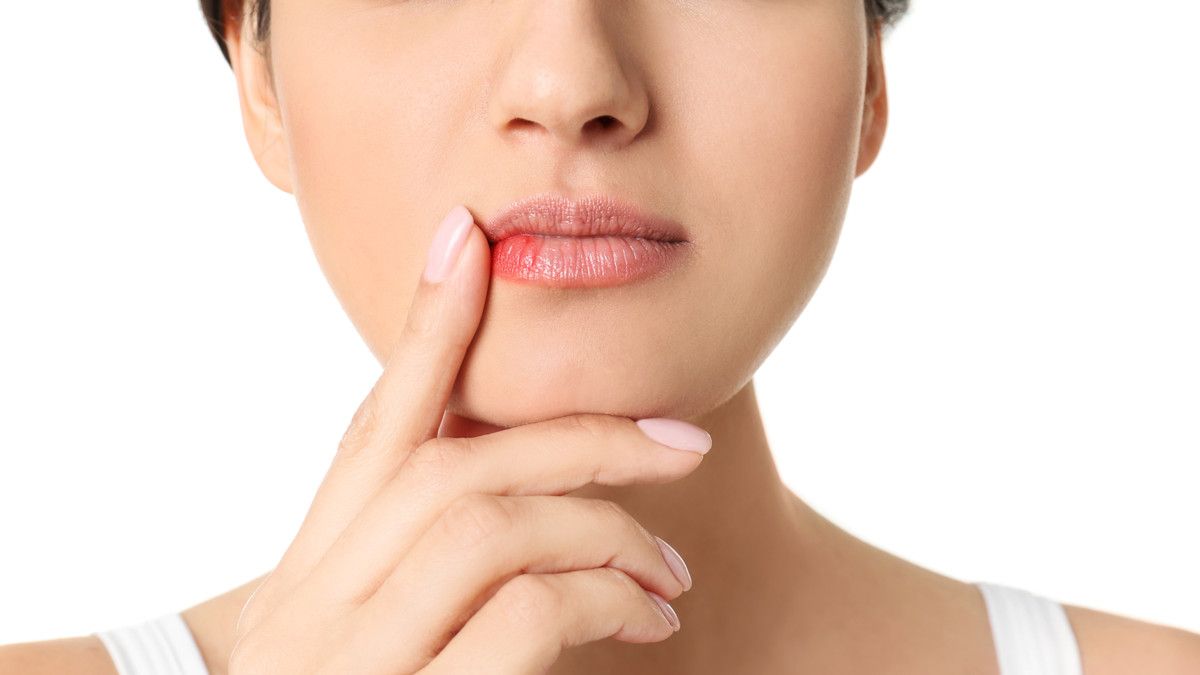 Penyakit yang Ditandai Luka pada Bibir