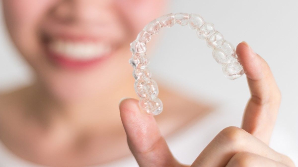 Berapa Lama Harus Pakai Behel Transparan agar Gigi Rata Maksimal?
