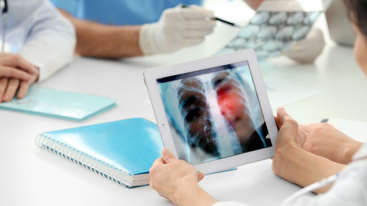 Artificial Intelligence Bisa Deteksi Dini Pneumonia COVID-19